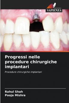 Progressi nelle procedure chirurgiche implantari