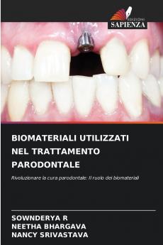 BIOMATERIALI UTILIZZATI NEL TRATTAMENTO PARODONTALE