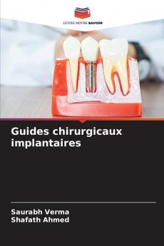 Guides chirurgicaux implantaires