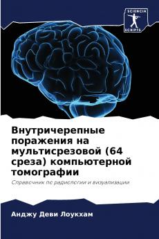 Внутричерепные поражения на мультисрезовой (64 среза) компьютерной томографии