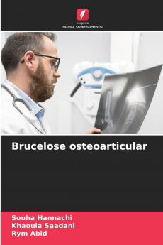 Brucelose osteoarticular