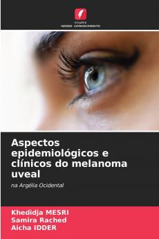 Aspectos epidemiológicos e clínicos do melanoma uveal