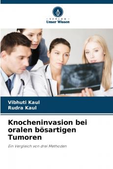 Knocheninvasion bei oralen bösartigen Tumoren