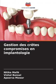 Gestion des crêtes compromises en implantologie