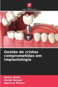 Gestão de cristas comprometidas em Implantologia