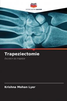Trapeziectomie