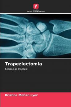 Trapeziectomia