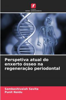 Perspetiva atual do enxerto ósseo na regeneração periodontal