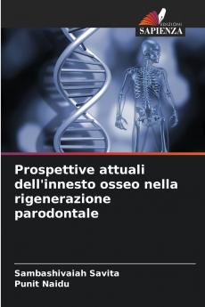 Prospettive attuali dell'innesto osseo nella rigenerazione parodontale