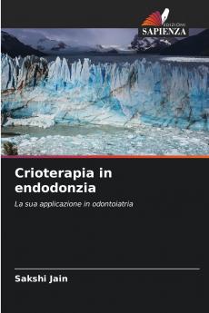 Crioterapia in endodonzia