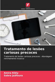 Tratamento de lesões cariosas precoces