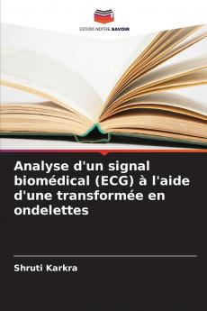 Analyse d'un signal biomédical (ECG) à l'aide d'une transformée en ondelettes