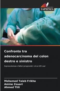 Confronto tra adenocarcinoma del colon destro e sinistro