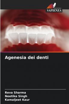 Agenesia dei denti