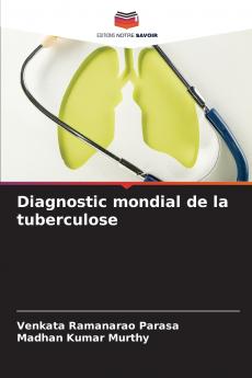 Diagnostic mondial de la tuberculose