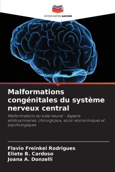 Malformations congénitales du système nerveux central