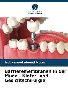 Barrieremembranen in der Mund- Kiefer- und Gesichtschirurgie