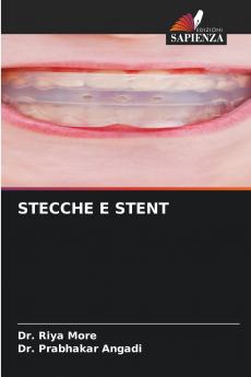 STECCHE E STENT