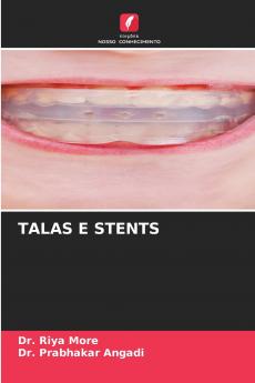 TALAS E STENTS