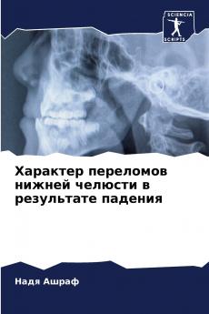 ???????? ????????? ?????? ??????? ? ?????????? ???????