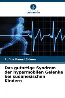 Das gutartige Syndrom der hypermobilen Gelenke bei sudanesischen Kindern