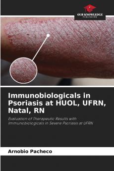 Immunobiologicals in Psoriasis at HUOL UFRN Natal RN