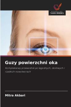 Guzy powierzchni oka