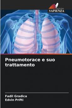 Pneumotorace e suo trattamento