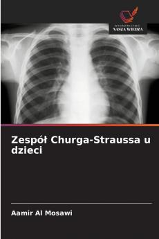 Zespół Churga-Straussa u dzieci