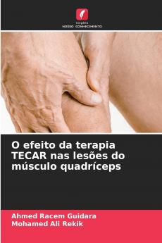 O efeito da terapia TECAR nas lesões do músculo quadríceps