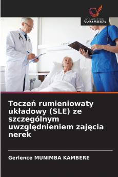 Toczeń rumieniowaty układowy (SLE) ze szczególnym uwzględnieniem zajęcia nerek