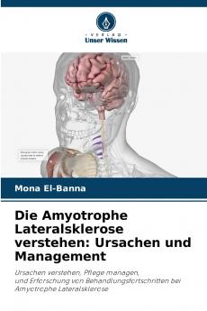 Die Amyotrophe Lateralsklerose verstehen