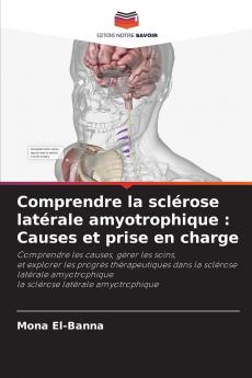 Comprendre la sclérose latérale amyotrophique
