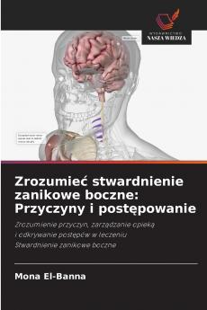 Zrozumieć stwardnienie zanikowe boczne