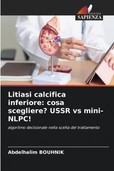 Litiasi calcifica inferiore