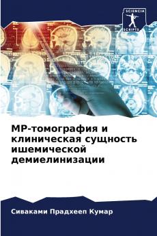 МР-томография и клиническая сущность ишемической демиелинизации