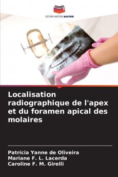 Localisation radiographique de l'apex et du foramen apical des molaires