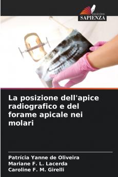 La posizione dell'apice radiografico e del forame apicale nei molari