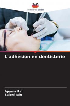 L'adhésion en dentisterie