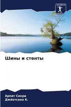 Шины и стенты