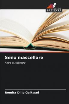Seno mascellare