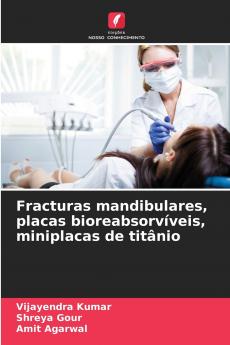 Fracturas mandibulares placas bioreabsorvíveis miniplacas de titânio
