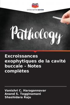 Excroissances exophytiques de la cavité buccale - Notes complètes