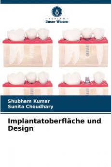 Implantatoberfläche und Design