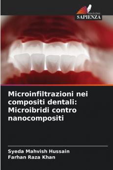 Microinfiltrazioni nei compositi dentali