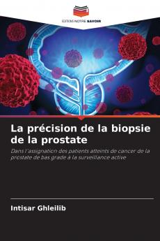 La précision de la biopsie de la prostate