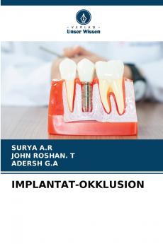 IMPLANTAT-OKKLUSION