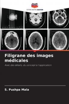 Filigrane des images médicales