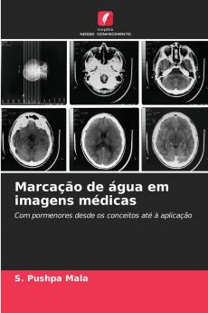 Marcação de água em imagens médicas
