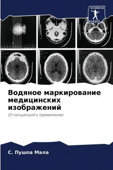 Водяное маркирование медицинских изображений